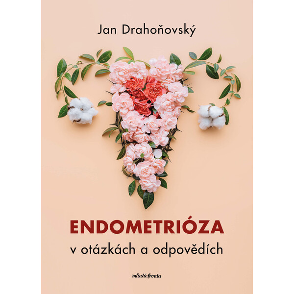 Endometrióza v otázkách a odpovědích