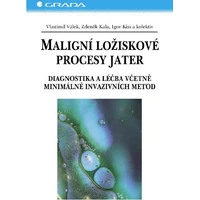 Maligní ložiskové procesy jater - E-kniha