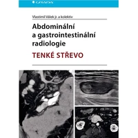 Abdominální a gastrointestinální radiologie - E-kniha