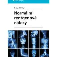 Normální rentgenové nálezy - E-kniha
