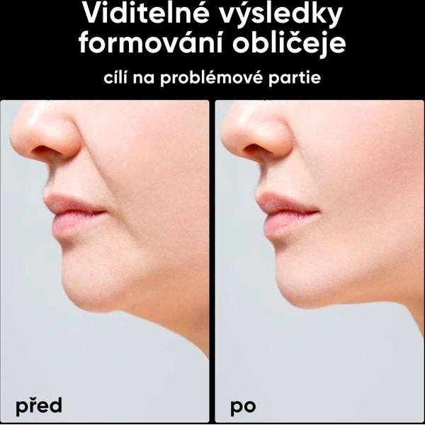 JOVS Slimax mikroproudový omlazující přístroj - Čističe pleti - Obrázek 2186beaaac8047e48599212a35ddad09