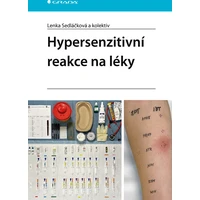 Hypersenzitivní reakce na léky - E-kniha