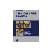 Cervical spine trauma - E-kniha