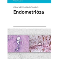 Endometrióza - E-kniha