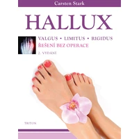 Hallux - E-kniha