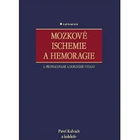 Mozkové ischemie a hemoragie - E-kniha