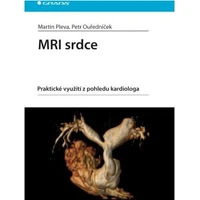 MRI srdce - E-kniha