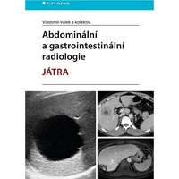 Abdominální a gastrointestinální radiologie - E-kniha