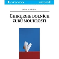 Chirurgie dolních zubů moudrosti - E-kniha