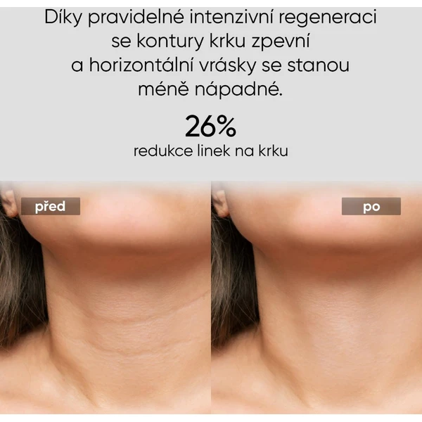 JOVS LED světelná maska na krk a hrudník - Čističe pleti - Obrázek 42838d2f364743caa827607c87bc3872