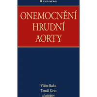 Onemocnění hrudní aorty - E-kniha