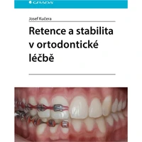 Retence a stabilita v ortodontické léčbě - E-kniha