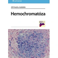 Hemochromatóza - E-kniha