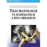 Traumatologie ve schématech a RTG obrazech - E-kniha
