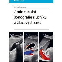 Abdominální sonografie žlučníku a žlučových cest - E-kniha
