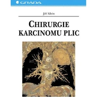 Chirurgie karcinomu plic - E-kniha