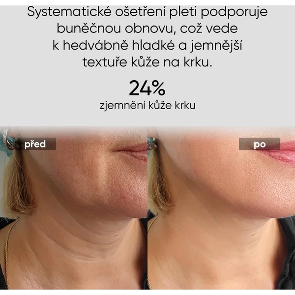 JOVS LED světelná maska na krk a hrudník - Čističe pleti - Obrázek 5e6aac9692fa48ad821b59719491997f