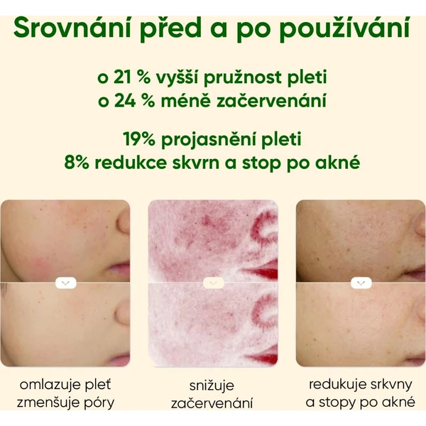JOVS Blacken Pro DPL fotofacial přístroj na péči o pleť - Čističe pleti - Obrázek 6113364259b34947ab8ba580e2069b00