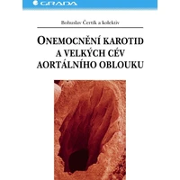 Onemocnění karotid a velkých cév aortálního oblouku - E-kniha