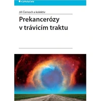Prekancerózy v trávicím traktu - E-kniha