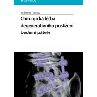 Chirurgická léčba degenerativního postižení bederní páteře - E-kniha