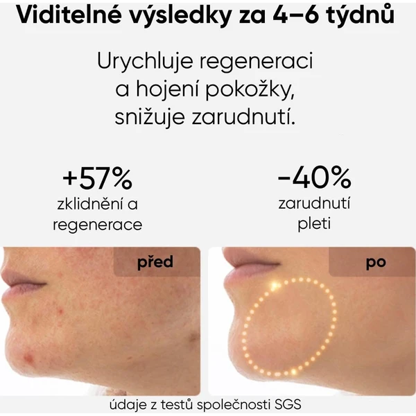 JOVS LED světelná terapeutická maska na obličej - Čističe pleti - Obrázek 6eb7a7f021f94b0396c8758680102b60