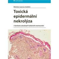 Toxická epidermální nekrolýza - E-kniha