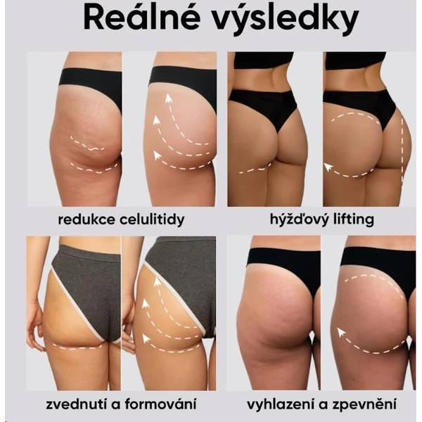 JOVS EMS tonizující šortky (F+) - Čističe pleti - Obrázek 7b895163d7a44855bc9f04c082ff4d7e