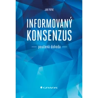 Informovaný konsenzus - poučená dohoda - E-kniha