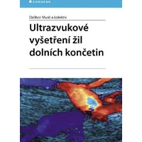 Ultrazvukové vyšetření žil dolních končetin - E-kniha
