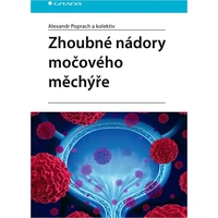 Zhoubné nádory močového měchýře - E-kniha