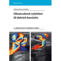 Ultrazvukové vyšetření žil dolních končetin - E-kniha