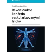 Rekonstrukce končetin vaskularizovanými laloky - E-kniha