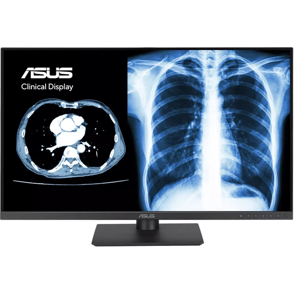 ASUS MH2441A klinický monitor 24" - Monitory - Obrázek WB4G000K01