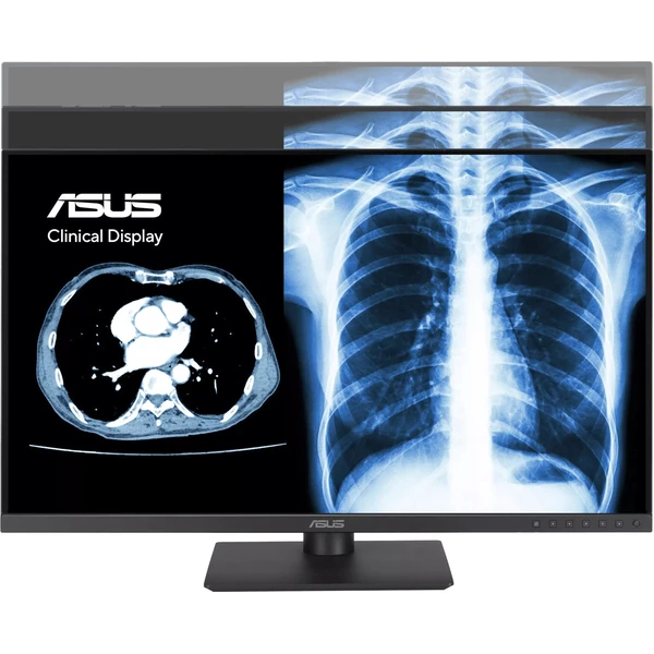 ASUS MH2441A klinický monitor 24" - Monitory - Obrázek XB4G000K01