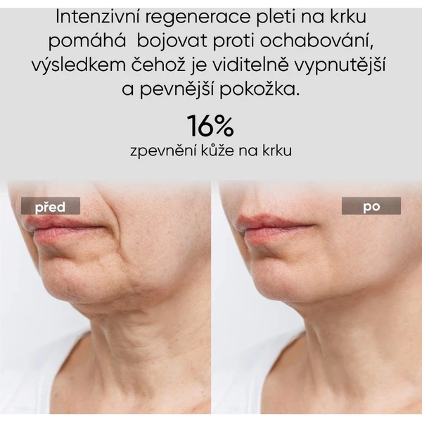 JOVS LED světelná maska na krk a hrudník - Čističe pleti - Obrázek a73c08cd7d414dcb87600b4a7db5217a