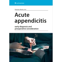 Acute appendicitis - E-kniha