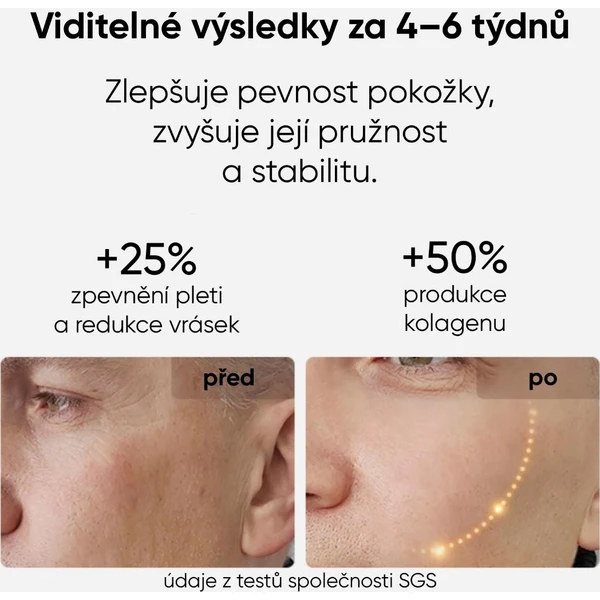 JOVS LED světelná terapeutická maska na obličej - Čističe pleti - Obrázek b00f3c342d1643c3bab05552c9f97f9a