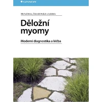 Děložní myomy - E-kniha