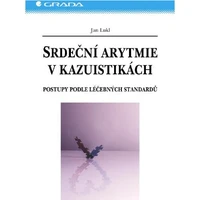 Srdeční arytmie v kazuistikách - E-kniha