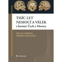 Tisíc let nemocí a válek z kostnic Čech a Moravy - E-kniha