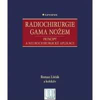 Radiochirurgie gama nožem - E-kniha
