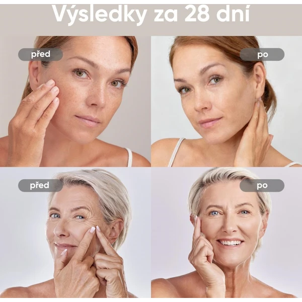 JOVS 4D v2 laserová světelná terapeutická maska - Čističe pleti - Obrázek b7bad0c543e44c6b8e3d381a42ed4d57