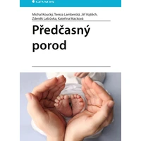 Předčasný porod - E-kniha