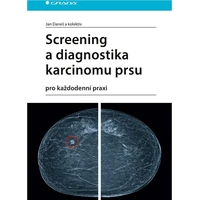 Screening a diagnostika karcinomu prsu - E-kniha