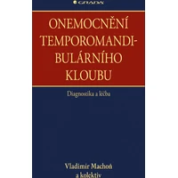 Onemocnění temporomandibulárního kloubu - E-kniha