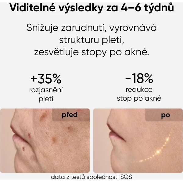 JOVS LED světelná terapeutická maska na obličej - Čističe pleti - Obrázek c9cd8f0a82d340d18a3f094c8e0cf477