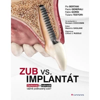 Zub vs. implantát - E-kniha
