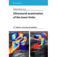 Ultrasound examination of the lower limbs - E-kniha