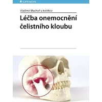 Léčba onemocnění čelistního kloubu - E-kniha